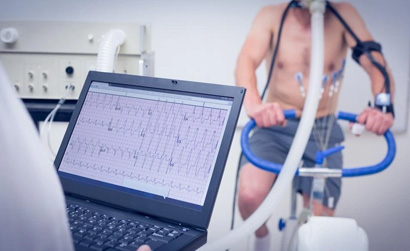 Peripheral Angiography